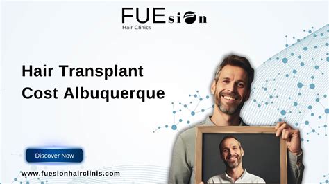 hair transplant albuquerque|Iba pa.